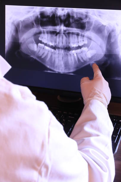 Best Emergency Root Canal Treatment in Wilton, IA